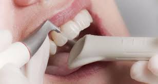 тщательная чистка зубов